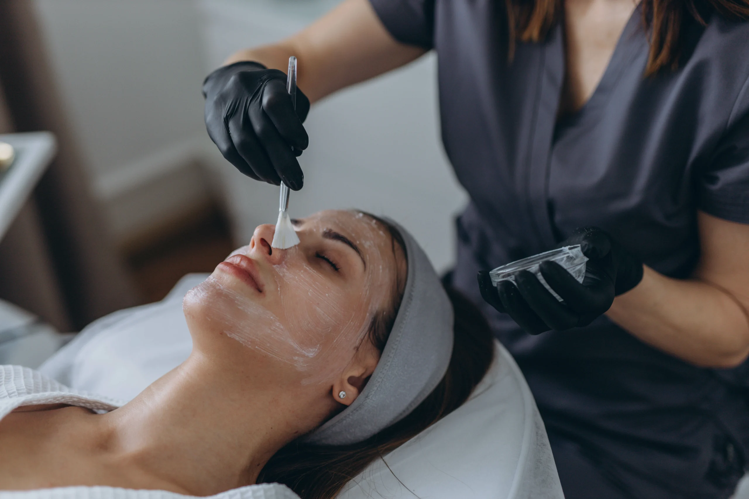 How Chemical Peels Improve Skin Texture and Tone